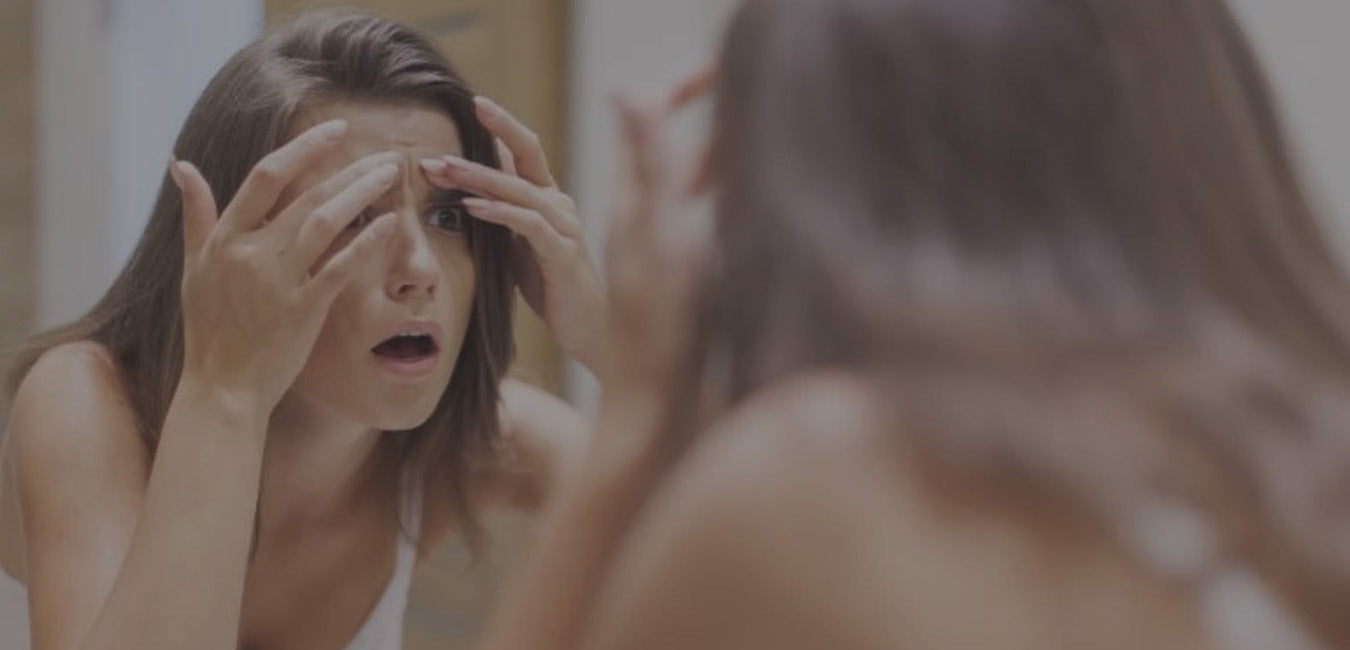 Extracting Your Acne is NEVER A Good Idea!